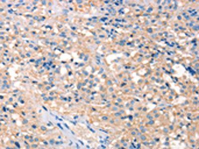 PRPS1/PRPS2/PRPS1L1 Antibody