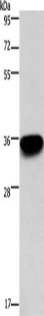 PRPS1/PRPS2/PRPS1L1 Antibody