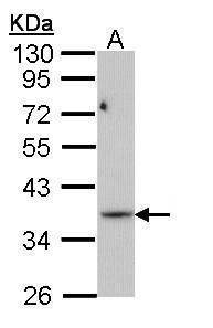 phosphoribosyl pyrophosphate synthetase 1 like 1 Antibody