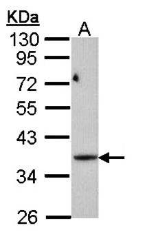PRPS1L1 Rabbit Polyclonal Antibody