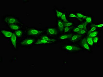 PRPS2 Antibody