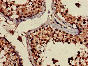 PRPS2 Antibody