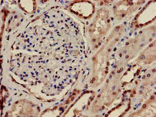 PRPS2 Antibody