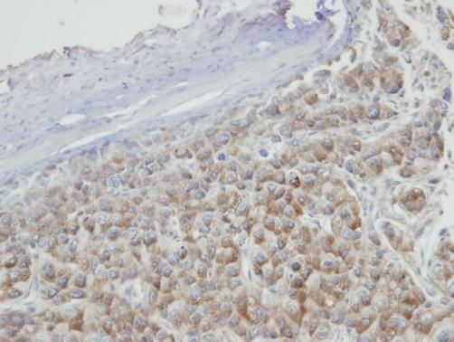 PRPS2 antibody [N1C3]