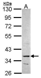 PRPS2 antibody [N1C3]