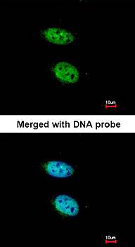 PRPS2 antibody