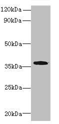 PRPSAP1 Antibody