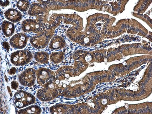 PRPSAP2 antibody [N1C3]
