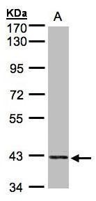 PRPSAP2 antibody [N1C3]