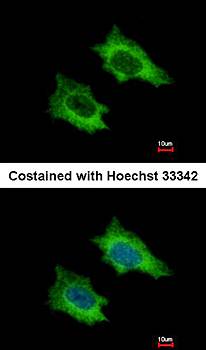 PRPSAP2 antibody