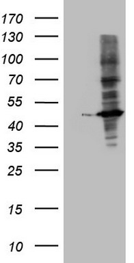 PRRX1 Antibody