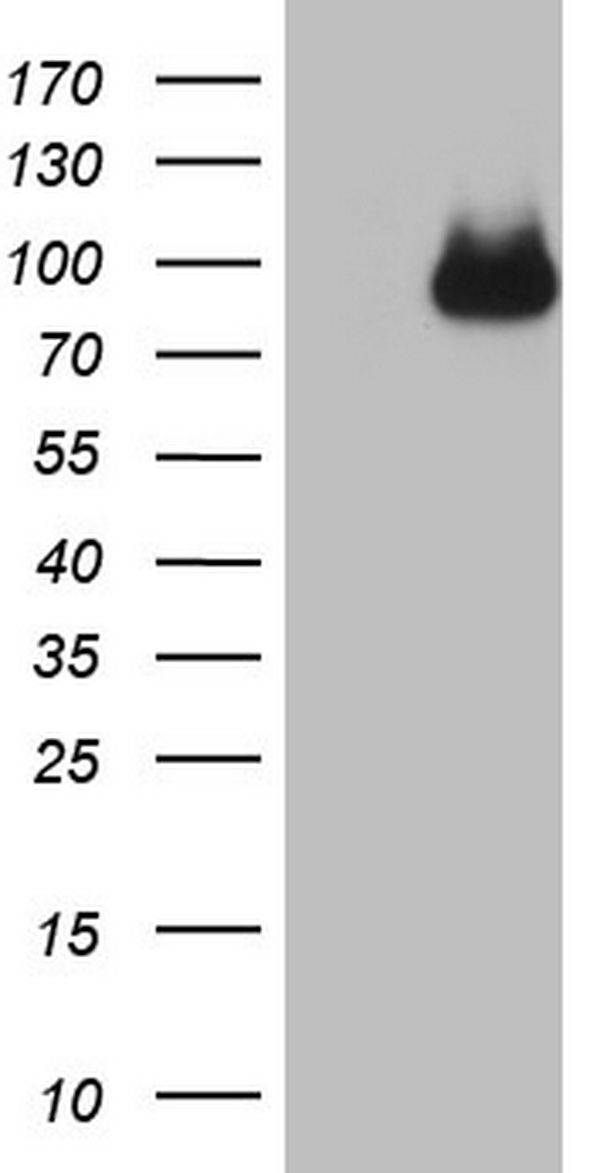 PRRX1 Antibody