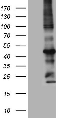 PRRX1 Antibody
