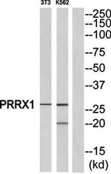 PRRX1 Antibody