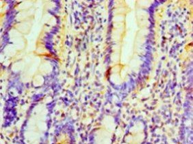 PRUNE1 Antibody