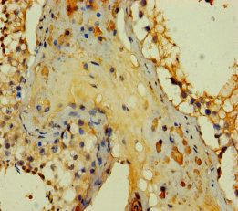 PRY Antibody
