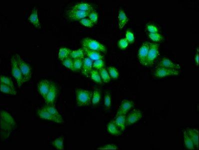 PSAT1 Antibody