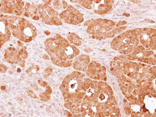 PSAT1 antibody [N1C3]