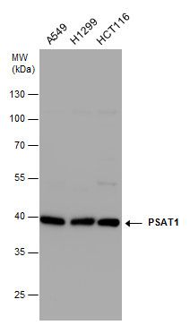 PSAT1 antibody [N1C3]