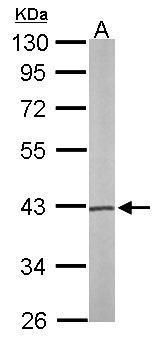 PSAT1 antibody [N1C3]