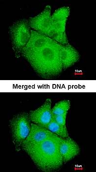 PSAT1 antibody