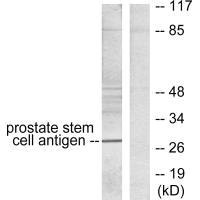 PSCA Antibody
