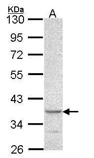 SCAP2 antibody [C2C3], C-term