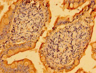 PSD Antibody