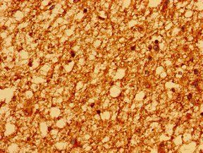 PSD Antibody