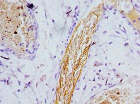 PSEN1 Antibody