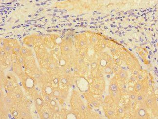 PSEN1 Antibody