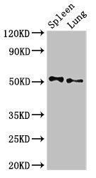 PSEN2 Antibody