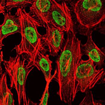 PSIP1 Antibody