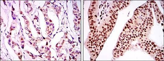 PSIP1 Antibody