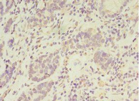 PSKH2 Antibody