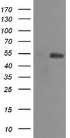 PSMA Antibody