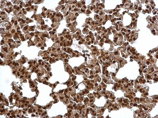 PSMA6 antibody