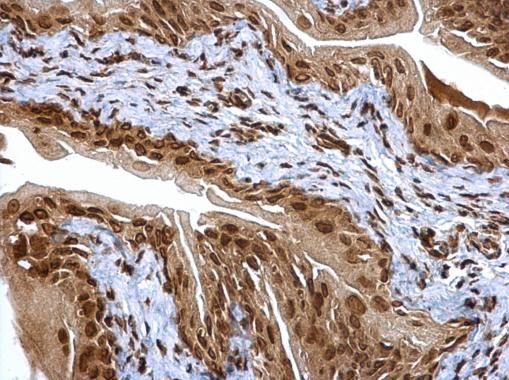 PSMA6 antibody