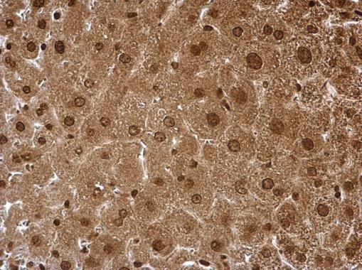PSMA6 antibody