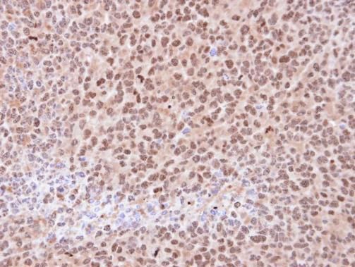 proteasome subunit alpha 6 Antibody