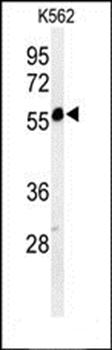 PSMAL antibody