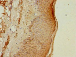 PSMB3 Antibody
