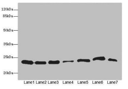 PSMB3 Antibody