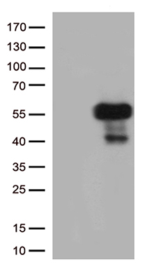 PSMB9 Antibody
