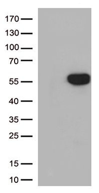 PSMB9 Antibody
