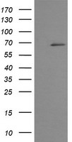 PSMB9 Antibody