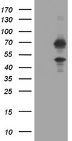 PSMB9 Antibody