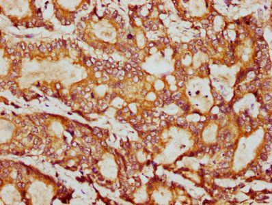 PSMB9 Antibody