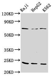 PSMB9 antibody