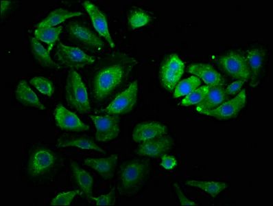 PSMC3 antibody